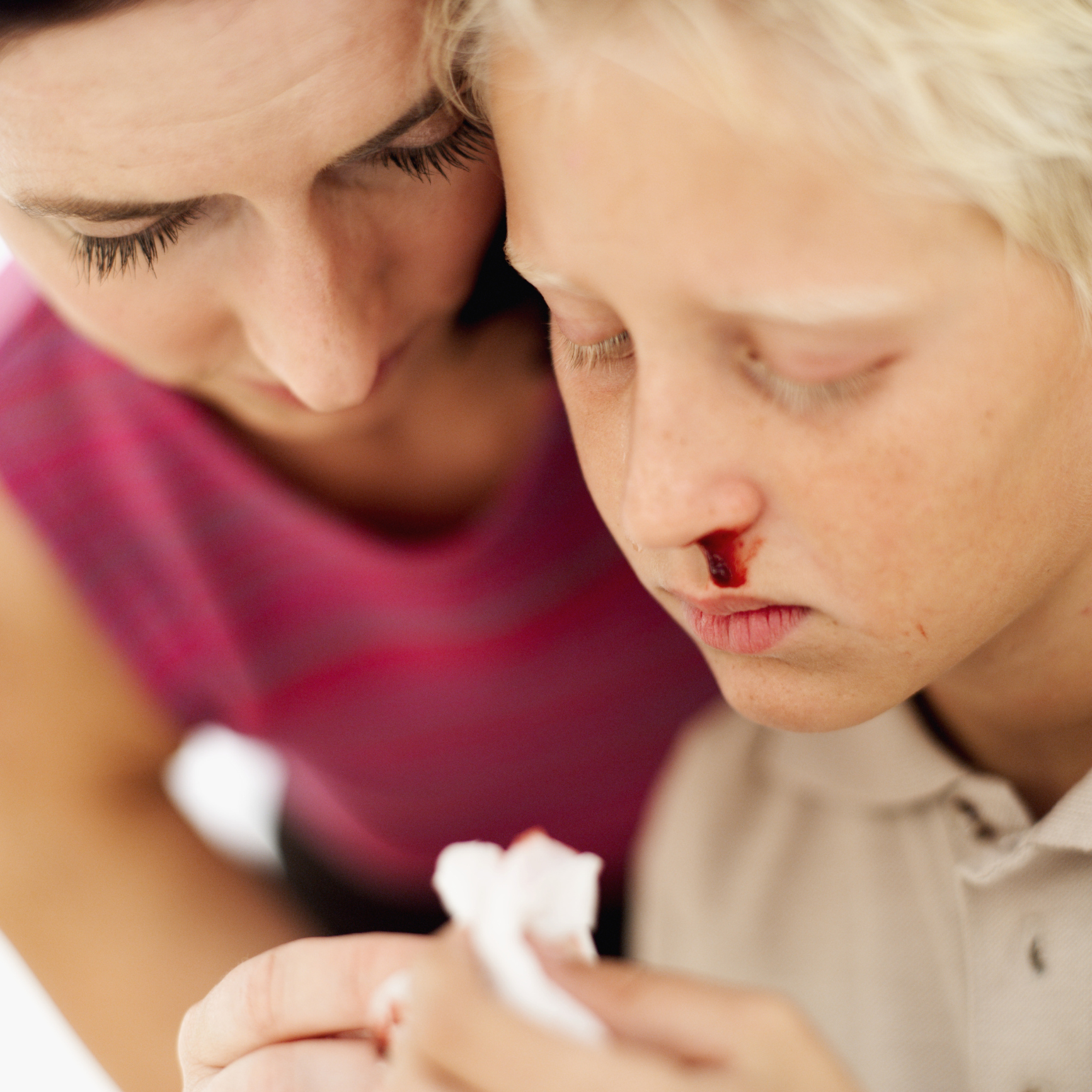 Первые признаки крови у детей. Кровотечение из носа у детей. Носовоекровотечениеудетец.