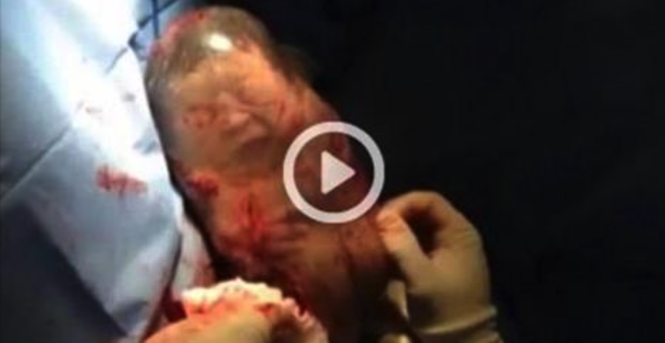 Fascinerende video! Baby komt ter wereld in volledig intacte vruchtzak
