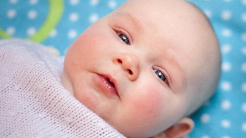 Gele zuigeling: Gele baby na Geboorte (Pasgeborene)