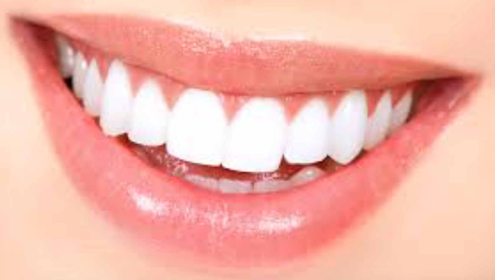 Hoe Moet Je Jouw Tanden Verzorgen Na Het Bleken? - Zutendaal thumbnail