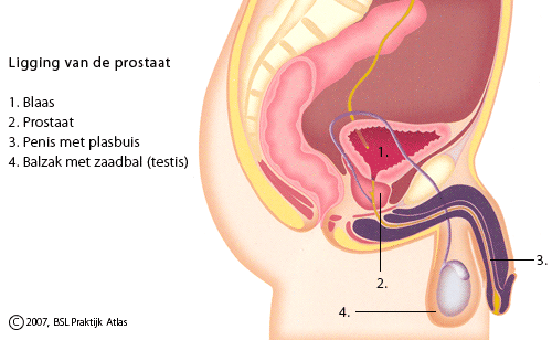 Chronische prostatitis symptomen